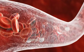 Mengenal 4 Gejala Kanker Pembuluh Darah Untuk Pencegahan