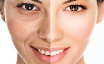 12 Tips dan Cara Agar Wajah Tidak Kusam Secara Alami