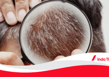 4 Cara Menghilangkan Uban dengan Bahan Alami. Dijamin Rambut Anda akan Sehat!