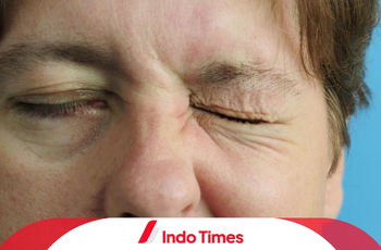 Apa Saja Gejala Penyakit Bell Palsy? Waspada dan Tangani dengan Tepat!