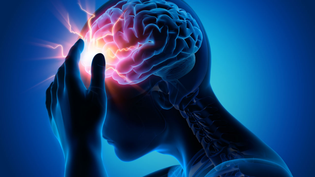 8 Faktor Gejala Pendarahan Otak yang Berakibat Fatal