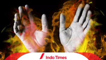 Santri Pasuruan Dibakar Hidup-hidup: Usai Dirawat 19 Hari, Korban Akhirnya Meregang Nyawa