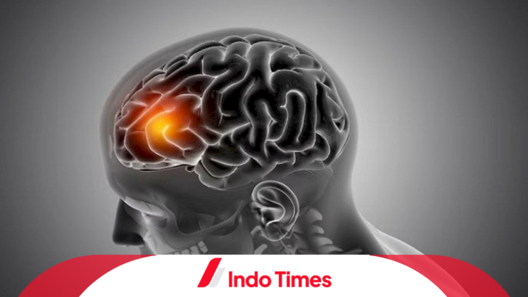 Fatal! David Idap Diffuse Axonal Injury Usai Dianiaya 1 Fatal! David Idap Diffuse Axonal Injury Usai Dianiaya