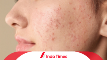 10 Rekomendasi Merk Skincare Penghilang Bruntusan Terbaik dari Domestik