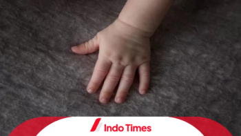 Gunting Perban Sampai Jari Bayi Terpotong di Palembang, Perawat RS Muhammadiyah Terancam Hukuman Penjara