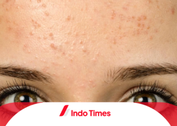 Ungkap 10 Rekomendasi Produk Skincare Penghilang Bruntusan Paling Ampuh