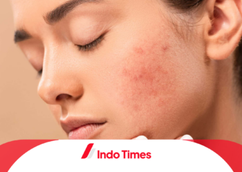 Rekomendasi 10 Produk Serum Untuk Menghilangkan Bekas Jerawat Paling Ampuh