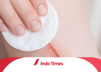 Obat Penghilang Bekas Luka