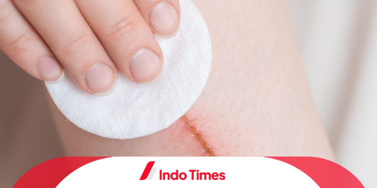 Obat Penghilang Bekas Luka