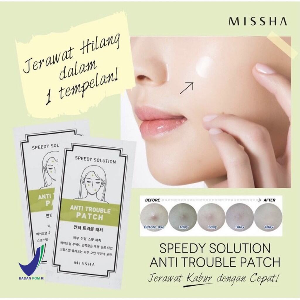 Missha Speedy Solution Anti Trouble Patch || Acne Patch Terbaik