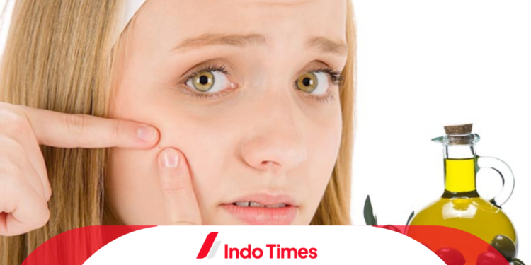 Merk Minyak Zaitun Untuk Wajah: 10 Rekomendasi Ini Cukup Ampuh Mengatasi Jerawat 1 Merk Minyak Zaitun Untuk Wajah: 10 Rekomendasi Ini Cukup Ampuh Mengatasi Jerawat