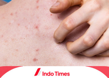 10 Rekomendasi Produk untuk Menghilangkan Jerawat Punggung yang Berkualitas