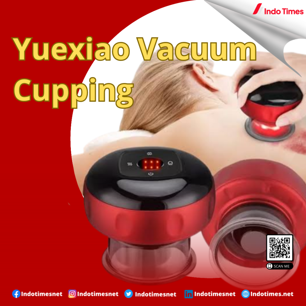 Yuexiao Vacuum Cupping || Alat Bekam Terbaik Rekomendasi Untuk Kesehatan