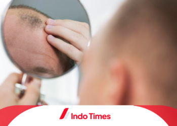 Model Rambut Pria Botak