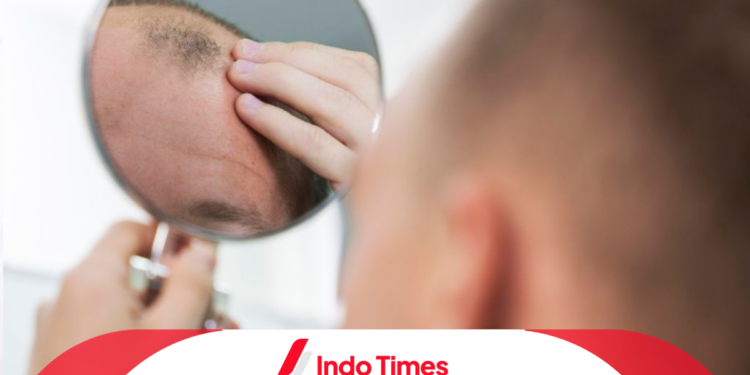 9 Rekomendasi Model Rambut Pria Botak Keren yang Wajib Dicoba 1 Model Rambut Pria Botak