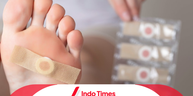 Indo Times 2 59 Rekomendasi 10 Merk Plester Mata Ikan yang Bagus dan Ampuh