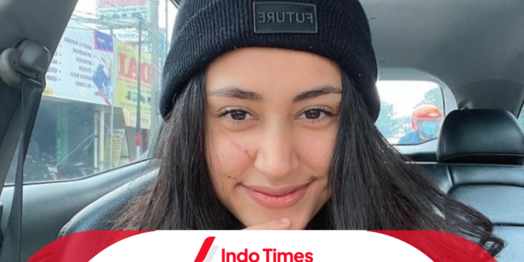 Afifah Riyad Dianiaya Mantan Pacar Suami Sampai Babak Belur 1 Afifah Riyad Dianiaya Mantan Pacar Suami Sampai Babak Belur