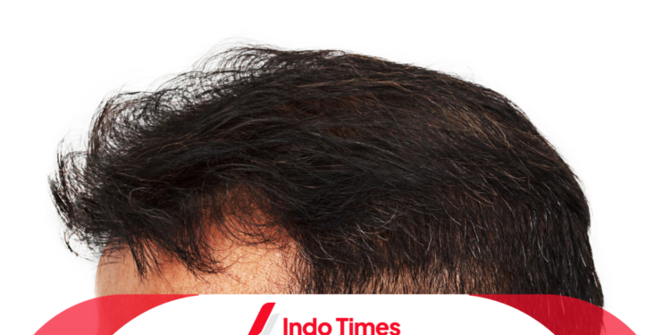 Potongan Rambut Tipis Pria: Rahasia untuk Tampil Lebih Percaya Diri