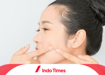 Bahaya Memencet Jerawat
