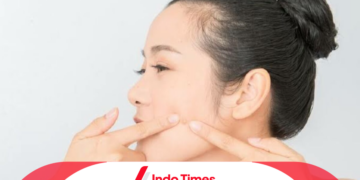 Bahaya Memencet Jerawat